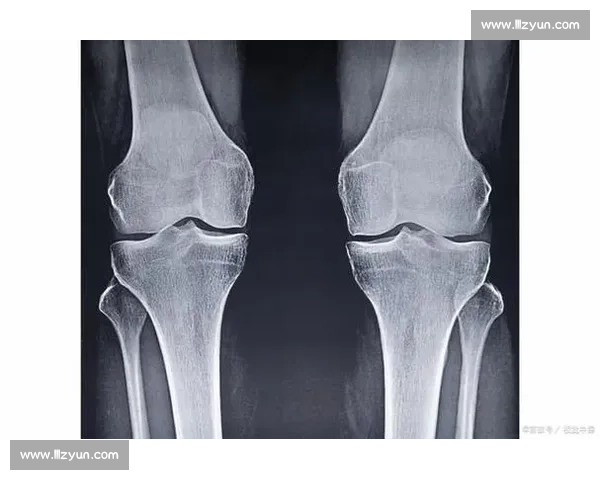 18 岁骨骺线未闭合?科学 3 招助你再长高 5cm 18 岁骨骺线未闭合?科学 3 招助你再长高 5cm
